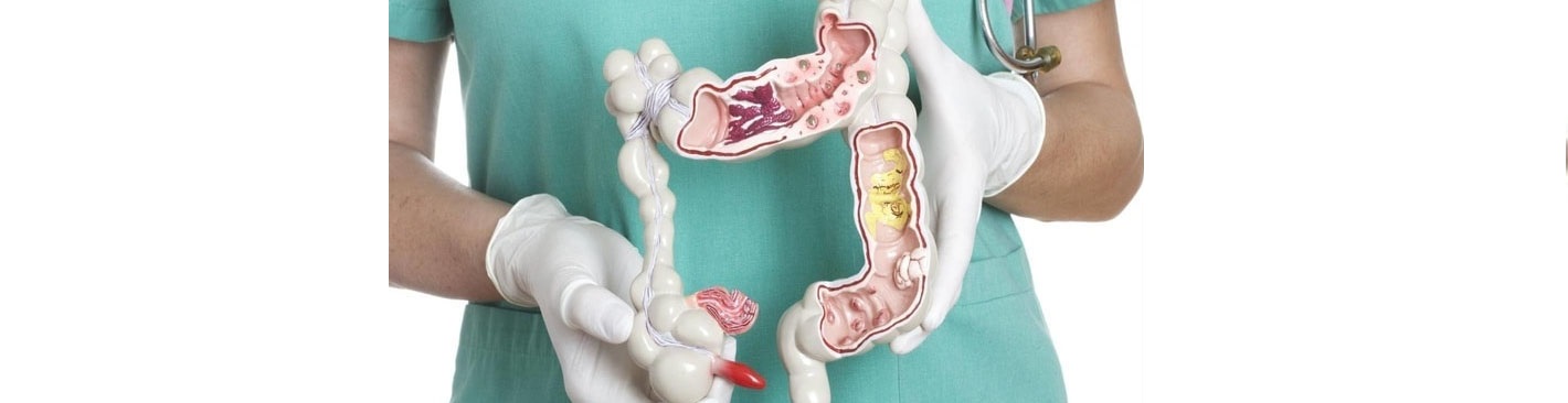 کولونوسکوپی چیست؟